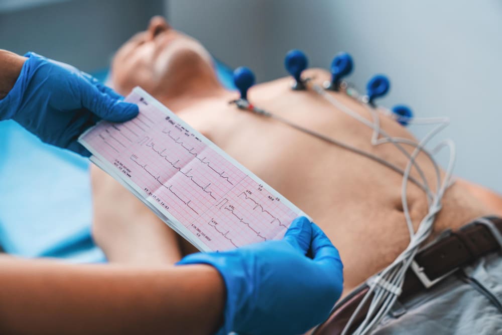 Electrocardiograma (ECG) de reposo