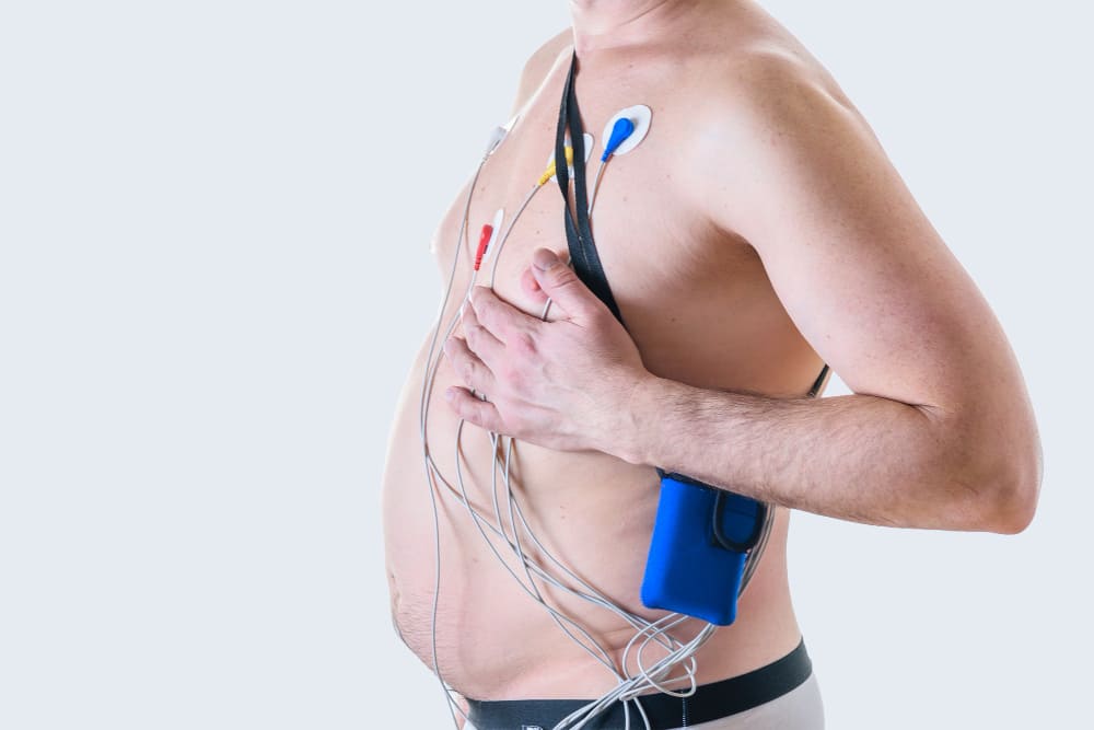 Holter ECG de 24 – 48 horas